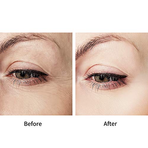 D.obsessed Retinol Eye Cream - Anti-aging Solution to Wrinkles, Crow\'s Feet, Dark Circles & Puffiness - Exclusive Formula of Retinol, Vitamin E, Hyaluronic Acid & Peptide (20g)