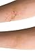 Miracle Plus Scar Removal Cream, Medical Reducing Scar Dressings and Stretch Mark Ointment, Professional Ultimate Skin Care Treatments and Products for Maternity,Weight loss, Cuts and Scabs, 15 Grams, Lifetime Satisfaction Guarantee