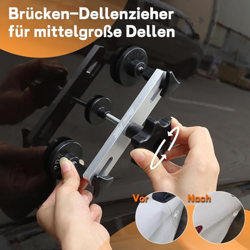 PDR Car Dent Repair Kit, Paint-Free Dent Removal Tool Set, Toothpuller, Suction Cup and Tool for Body, Ideal for Medium and Small Dents, Hail Damage and Dents