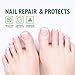 Anti-Fungus Nail Repair Pen by VieBeauti: Restores & Rehydrates Damaged Nails, Effective on Fungal Infection [4-Piece-Set: Maximum Strength]