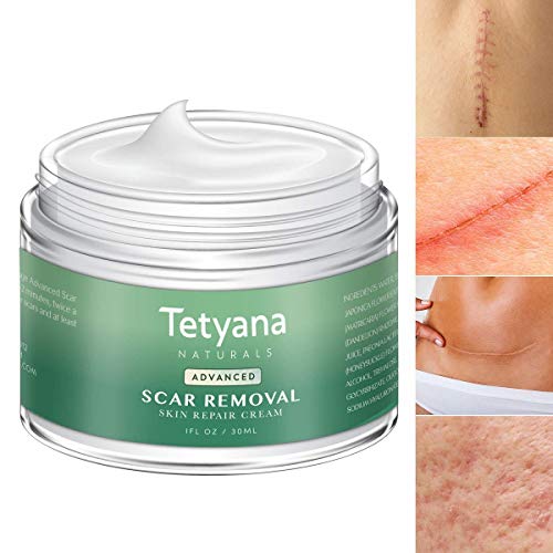 Scar Removal Cream Advanced Treatment for Old & New Scars from Cuts Stretch Marks, C-Sections & Surgeries With Natural Herbal Extracts Formula