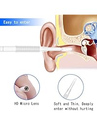 Oreja Otoscope, Endoscopio de oreja inalámbrico, 1.3 Megapíxeles WiFi Cámara de alcance auditivo USB herramienta de limpieza, cámara de inspección digital con 6 LED ajustables para iPhone y Android Smartphone, Windows
