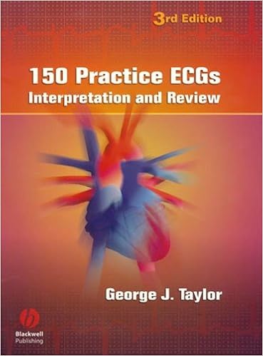 150 Practice Ecgs Interpretation And Review Taylor George J 9781405104838 Amazon Com Books
