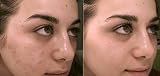 First Lady Skin Brightening Glycerin AHA Fruit Acids 400ml Dry Skin view 2
