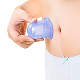 EPABO Silicone Anti Cellulite Suction Cup, Anti-aging Massage Set Cupping Therapy, Chinese Acupuncture Vacuum Cups for Body Natural Pain Relief Wrinkles Reduction 1 （Large） size and 1 （Medium） size