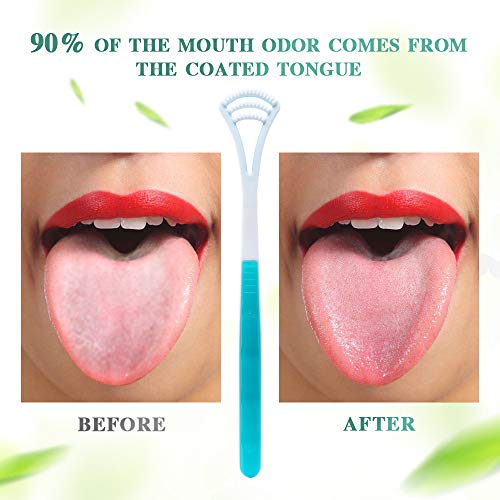 1 Tongue+Scraper+Cleaner+Stainless+Scraping