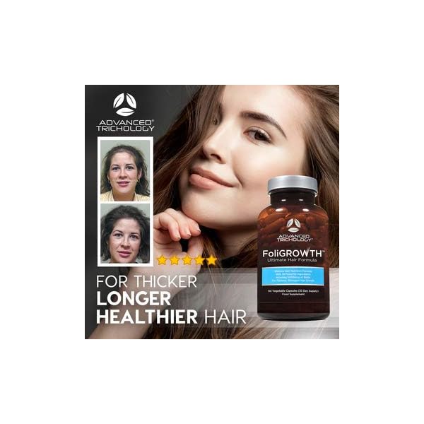 FoliGROWTH-Ultimate-Hair-Growth-Nutraceutical-Gluten-Free-Vegan-Formula-3rd-Party-Tested-with-High-Potency-Biotin-Stop-Hair-Loss-Get-Thickest-Strongest-Hair-Growth FoliGROWTH Ultimate Hair Growth Nutraceutical - Gluten Free, Vegan Formula, 3rd Party Tested - with High Potency Biotin…