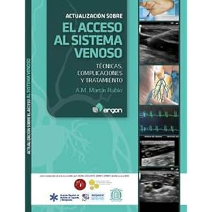 ActualizaciÃ³n sobre el acceso al sistema venoso: TÃ©cnicas, complicaciones y tratamiento