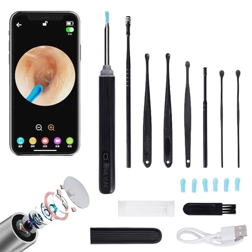 Ear Wax Removal with Camera - Ear Cleaner with Light, Comprehensive Kit for iPh…
