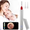 HealthneSS Ear Wax Removal,Wireless Otoscope Earwax Removal Tool 1080P HD WiFi Ear Endoscope with LED Light,3.5mm Mini…