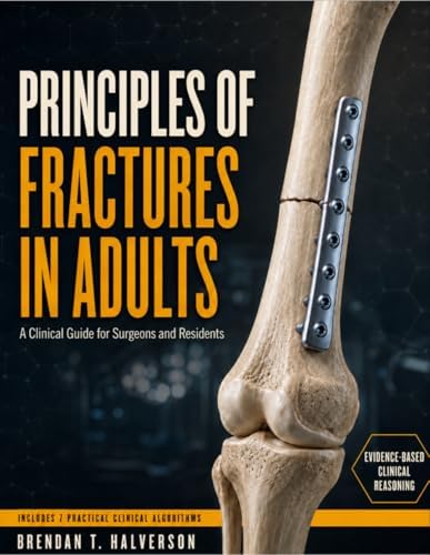 Ao Principles of Fracture Management: 9780865778863: Medicine