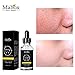 Mabox Premium Hyaluronic Acid Serum for Skin with Vitamin C & E for Face, Anti-Aging Topical Facial Serum