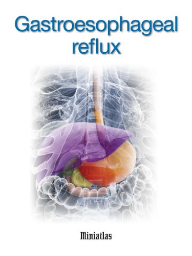 Amazoncom Gastroesophageal Reflux Miniatlas Ebook Luis - 