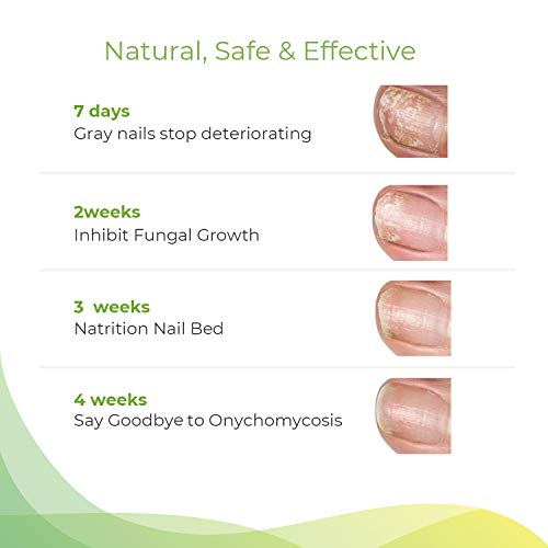 5 Samsali+Toenail+Treatment+Effective+Fingernail