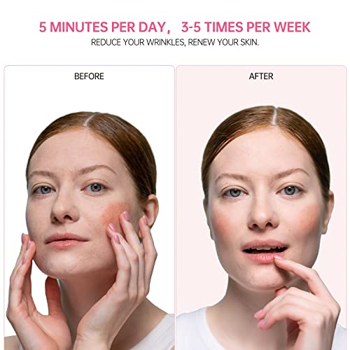 USUIE 4 in 1 Facial Wand, Red Light Therapy for Face and Neck, Facial