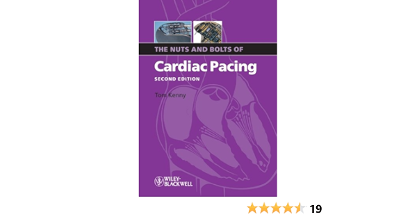 The Nuts And Bolts Of Cardiac Pacing Nuts And Bolts Series Replaced By 5113 Book 12 Ebook Kenny Tom Amazon Ca Kindle Store