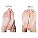 Emjoi Micro-Pedi Refill Rollers (Xtreme Coarse) - by Pedi Active