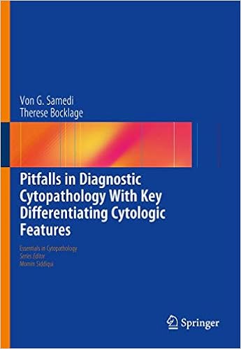 Pitfalls In Diagnostic Cytopathology With Key Differentiating Cytologic Features Essentials In Cytopathology 27 9783319398075 Medicine Health Science Books Amazon Com