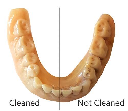 3 iSonic+F3900+Ultrasonic+Retainers+Appliances