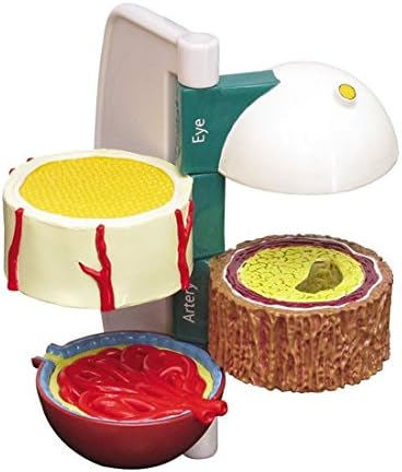 Diabetes Organ Damage 4-pc Anatomical Model