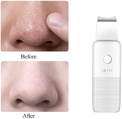 Skin Scrubber Face Spatula Facial Scrubber Blackhead Remover Pores Cleanser Comedones Extractor Pimple Cleanser Facial Dirty Exfoliator For Facial Deep Cleansing Buy Online At Best Price In Uae Amazon Ae