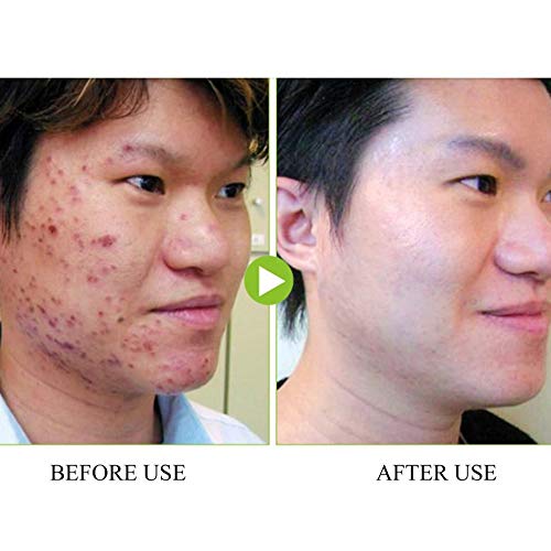 Nutrition Deep Cleaning Mung Bean Paste Mud Facial Mask Cream Moisturizing Brightening Shrink Pores Oil-Control Cleanser 2018 - Thumbnail 3
