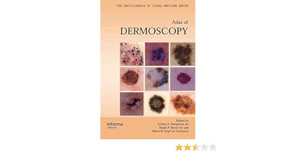 an atlas of dermoscopy encyclopedia of visual medicine series