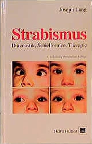 Strabismus Diagnostik Schielformen Therapie Amazon De Lang J Witmer R Bucher