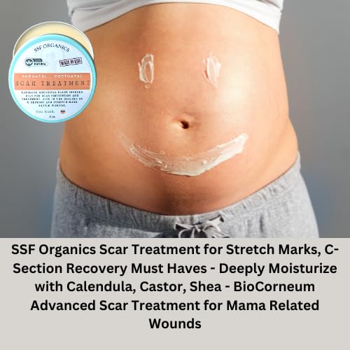 SSF Organics Scar Treatment for Stretch Marks, C-Section Recovery Must Have- Deeply Moisturize with Calendula, Castor, Shea - Advanced Scar Treatment for Mama Related Wounds
