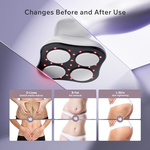 Oranmagic Body Sculpting Machine - Reduce Stretch Marks & Cellulite Massager Tool with Heating & Microcurrent Technology, Skin Tightening Device Suitable for Belly, Waist, Arms, Buttocks, Legs (White)