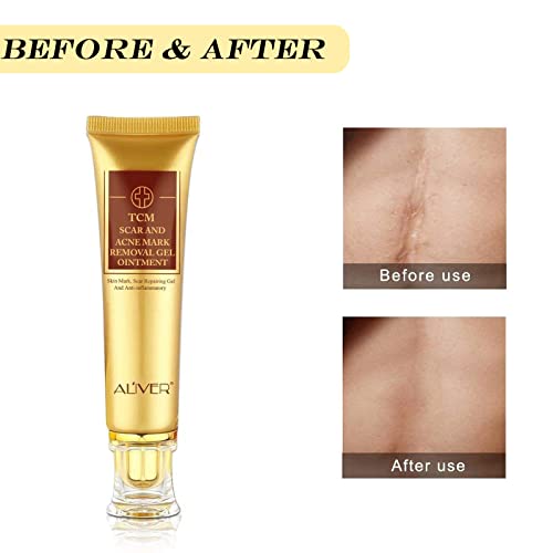3 Pack Scar Removal Cream TCM Scar Cream for Surgical Scars, Acne