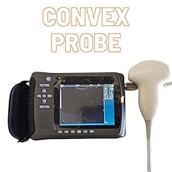 2023 Convex Newest Ultrasound Machine for Pregnancy