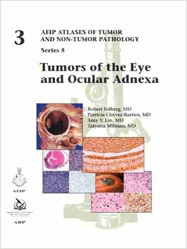 Tumors Of The Eye And Ocular Adnexa Afip Atlas Of Tumor And Non Tumor Pathology Series 5 Robert Folberg Author Patricia Chevez Barrios Author 9781933477923 Amazon Com Books Tumors Of The Eye And Ocular Adnexa Afip Atlas Of Tumor And Non Tumor Pathology Series 5 Robert Folberg Author Patricia Chevez Barrios Author 9781933477923 Amazon Com Books