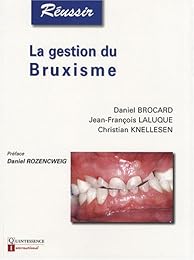 La  gestion du bruxisme