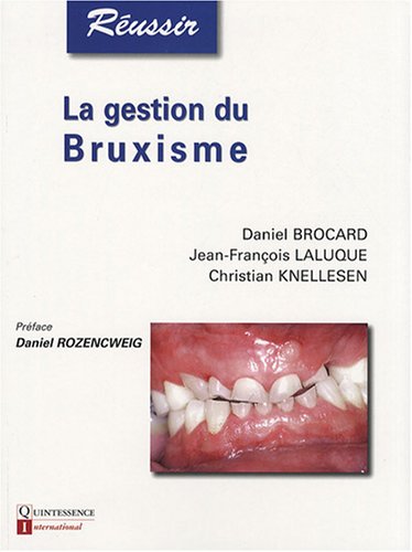 La  gestion du bruxisme