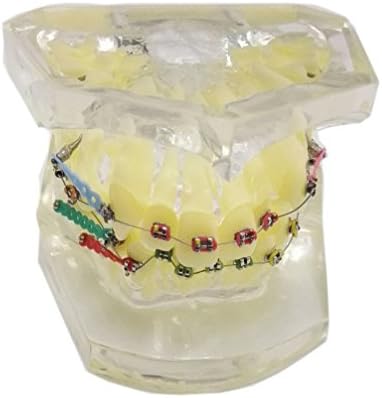 Commart Dental orthodontic plastic teeth study model with elastic bands bracket and elastic chain (Transparent)