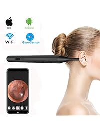 Oreja Otoscope, Skybasic cámara de oreja inalámbrica 1.3 Megapíxeles WiFi Ear Scope Ear Cleaning Endoscopio con 6 LED Earwax removedor para iOS y Android Smartphone, iPhone, Samsung, Tablet