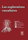 Image de Les Explorations vasculaires (French Edition)