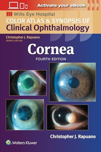 Glaucoma: 2-Volume Set: 9780702051937: Medicine & Health Science