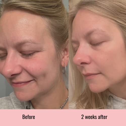 Vitamin C Serum, Hyaluronic Acid Serum for Face, Anti Aging, Menopause Support, Skin Care