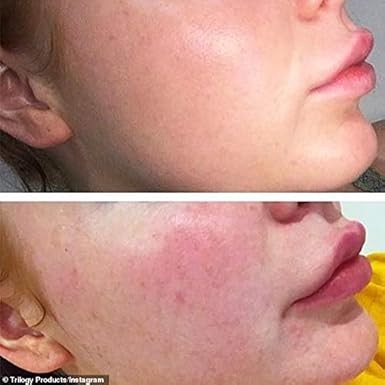 trilogy vitamin c serum