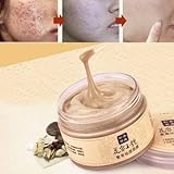 MEIKING Chinese Medicine Herbal Gromwell Mask Anti Acne Blackhead Remove Whitening Moisturizing by Completestore