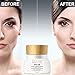 Eye Cream For Dark Circles and Puffiness - Anti Aging Wrinkle Remover Eye Gel - Under Eyes Treatment for Men and Women