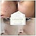 LANBENA Snail Facial Acne Repair Whitening Cream Day Cream for Repairs Acne Scars+Tightens Pores+Anti Wrinkle Anti Aging Moisturizing Firming