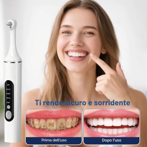 Professional Teeth Whitening Tartar Remover Kit with 5 Modes Teeth Cleaning Whitening Teeth Polisher with 6 Polishing and Whitening Accessories