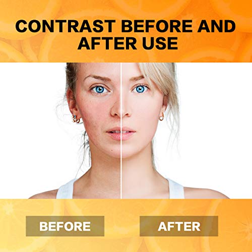 best serum for sun damage