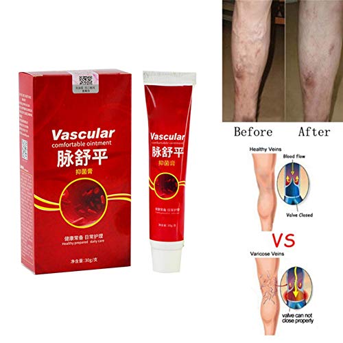 Buy 2 Pack Varicose Veins Cream, Phlebitis Angiitis Inflammation Blood