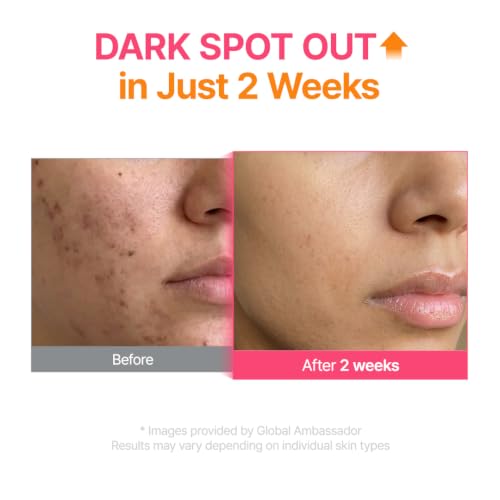 PURITO TXA 6% + Niacinamide 10% Facial Serum | for Dark Spots, Hyperpigmentation, Uneven Skin Tone | High-Concentration Tranexamic Acid | Korean Skincare, 30mL 1.01 fl.oz