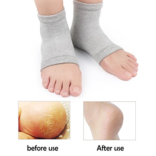 Amcami 4 Pairs Open Toe Heel Moisturizing Gel Socks Soft Ventilate Gel Heel for Dry Hard Cracked Skin Comfy Day Night Care Skin (Gray,Green,Pink,Black)