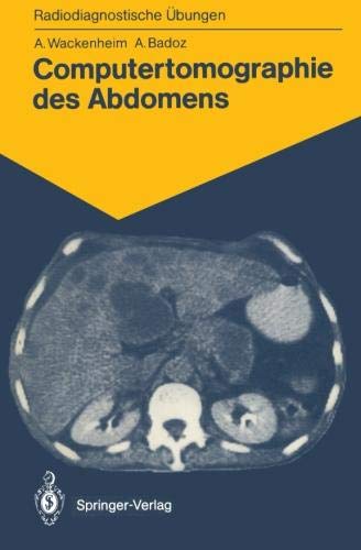 Computertomographie des Abdomens: 85 diagnostische Übungen für Studenten und praktische Radiologen (Radiodiagnostische Übungen) (German Edition)